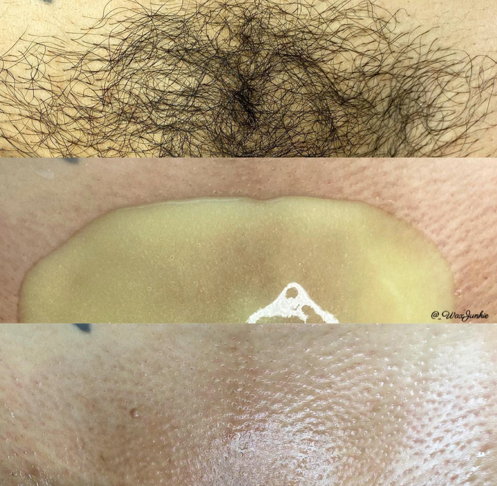 Brazilian Wax Before and After Page 2 — free download