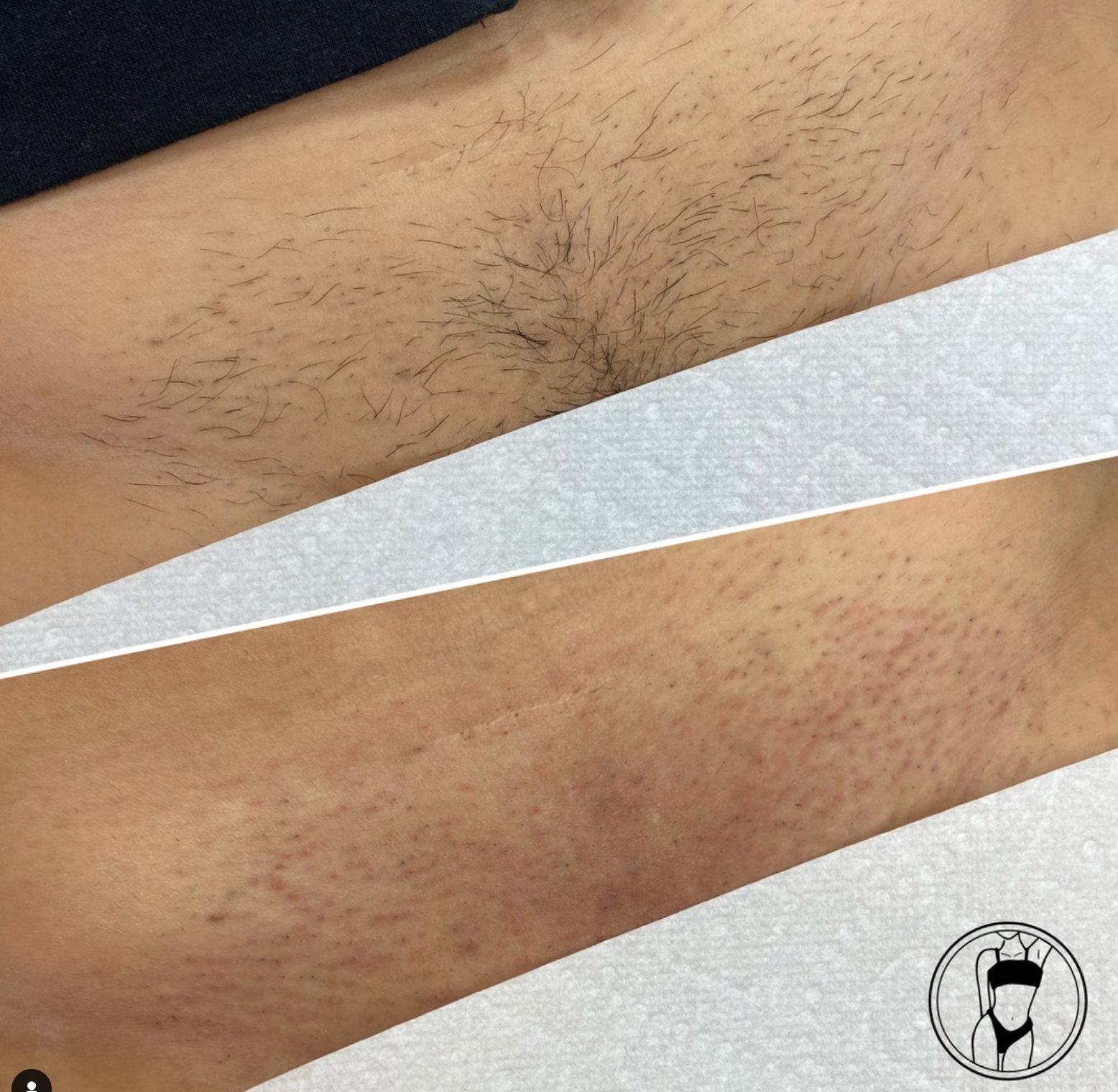 Before and after a brazilian wax by Melted Wax Studio in Texas