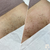Before and After Brazilian Waxing Lower Thigh