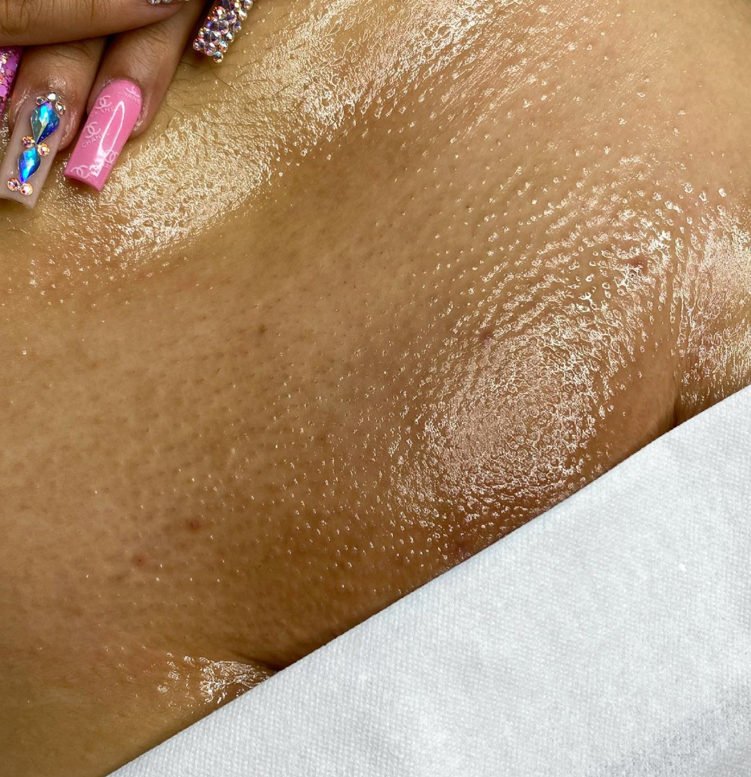 Brazilian Wax Before and After Photos
